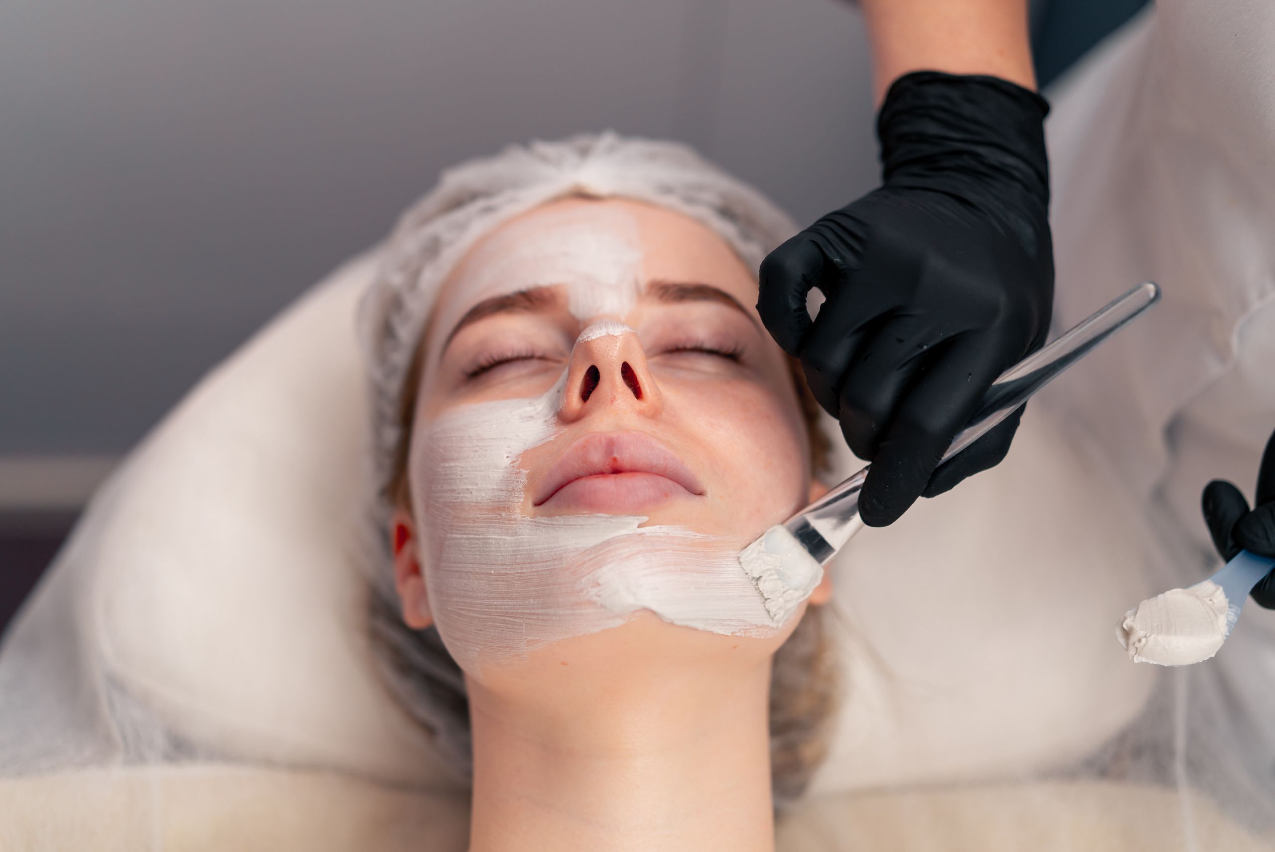 Best Doctors for Acne treatment in Raipur