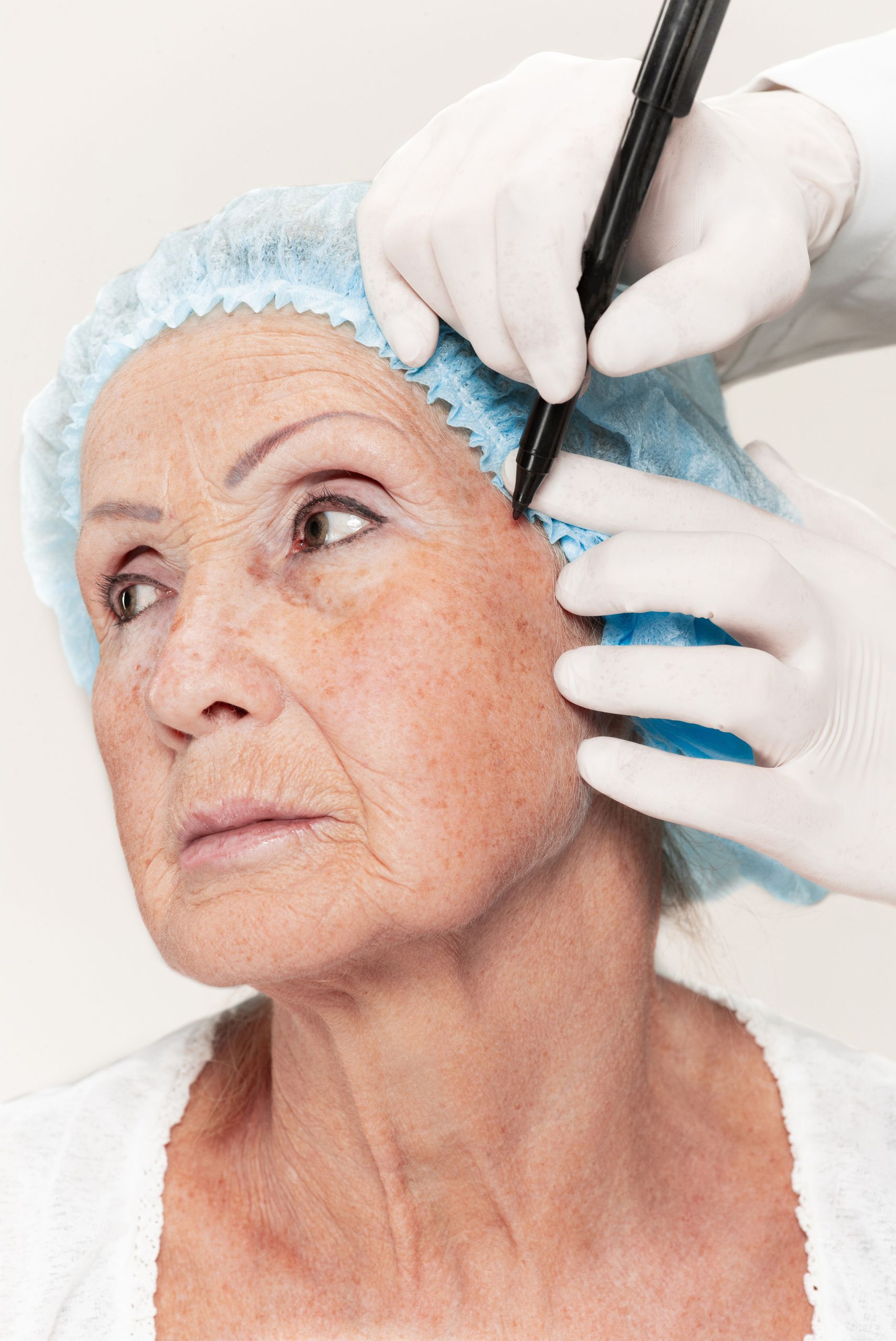 Top Skin Specialist near Shankar Nagar