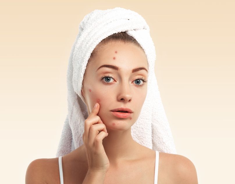 Best Doctors for Acne Treatment in Raipur